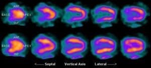 Online Associates in Nuclear Medicine Technology