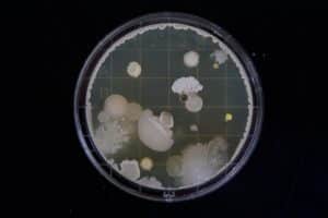 Online Bachelors in Microbiology